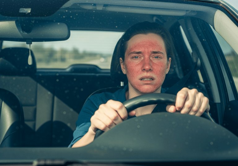 lupus and window tint medical exemptions